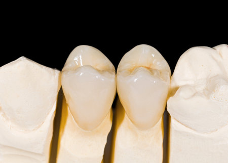 Ceramic premolar crowns  on isolated black backgroundの写真素材