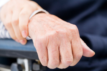Elderly womans hand resting on a wheelchairの写真素材