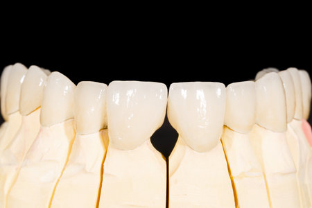 Dental zirconia bridge on isolated black backgroundの写真素材