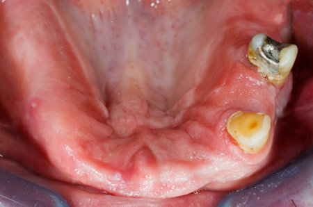 Close up photo of old amalgam fillings in oral cavity