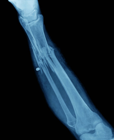 broken leg