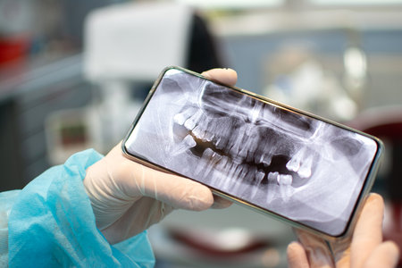 Close up of dentists hands in protective gloves holding mobile smart phone showing patients Dental...