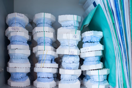 Dental gypsum models of jaws in dentists office.の写真素材