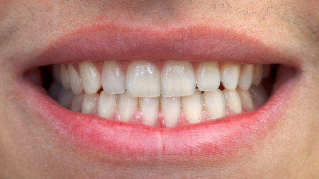 Close-up of man mouth with white teethの写真素材