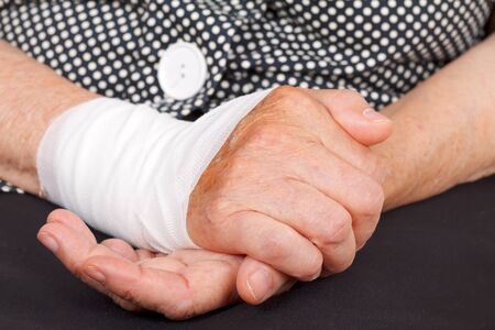 Close up of a senior hand with wrist contusionの写真素材