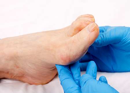 Doctor hand examining an elderly patient's footの写真素材