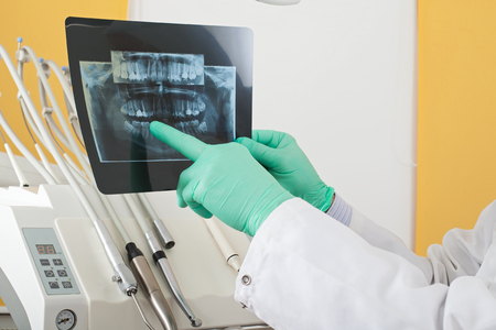 Close up picture of male dentist examining patient's dental panoramic radiography