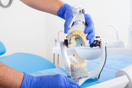 Dentist using dental articulator for a correct occlusion