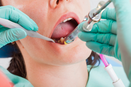 Close up picture of  woman at the dentist office receiving local anesthesia before dental procedureの写真素材