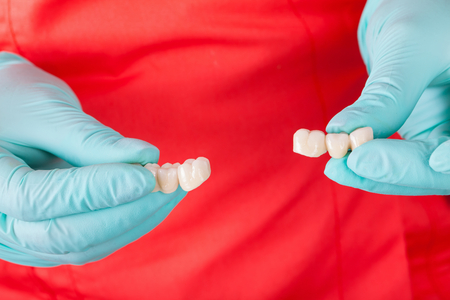 Close up picture of dentist holding ceramic dental bridge on red backgroundの写真素材
