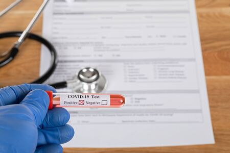 Close up picture of positive covid-19 blood test and medical supplies, treatment, mask and gloves on...