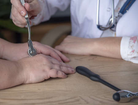 The doctor checks the pain sensitivity with the Wartenberg wheel on the patient's arm.の写真素材
