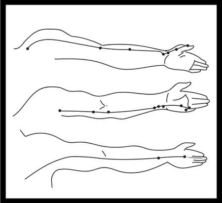 A black and white image of a human hand in three different positions with a marked center line and acupuncture points.のイラスト素材