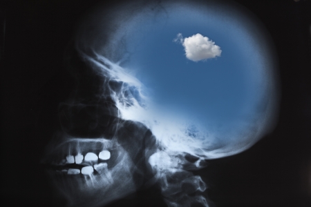 X-Ray of human skull with blue sky and cloud
