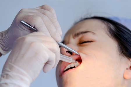 Woman having teeth examined at a dentistsの写真素材