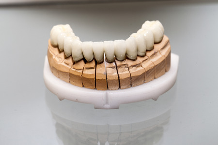Zirconium Porcelain Tooth plate in Dentist Storeの写真素材