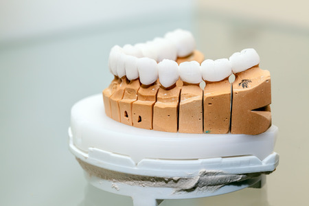 Zirconium Porcelain Tooth plate in Dentist Storeの写真素材