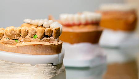 Zirconium Porcelain Tooth plate in Dentist Store