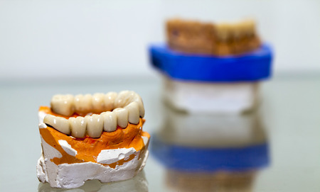 Zirconium Porcelain Tooth plate in Dentist Store
