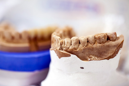 Zirconium Porcelain Tooth plate in Dentist Storeの写真素材