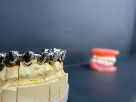 A professional medical dental model showing a high quality prosthetic zirconium tooth crown on a...