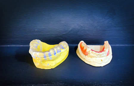 A professional medical dental model showing a high quality prosthetic zirconium tooth crown on a...