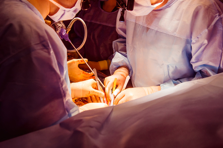 Close up surgical operation prosess using laparoscopic equipment in modern clinic. Dark shootの写真素材