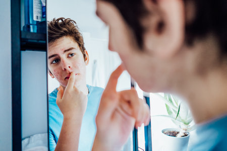 Concentrated caucasian teenage boy with acne problem at his face looking in mirror at home bathroom. Teenager skin care every day treatment process. Selective focus.の写真素材