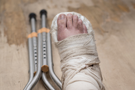 Broken leg in plaster on a shabby wooden floorの写真素材