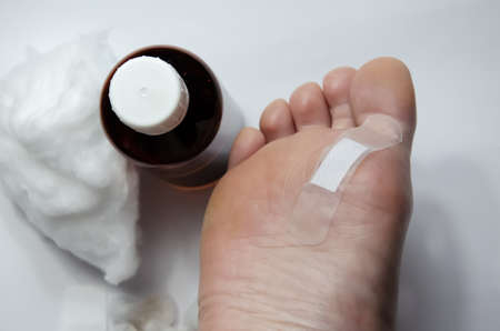 Close up foot with plaster. Injury feet next to bottle of peroxide and cotton wool. Podology: removal of warts. Caucasian adult woman's foot. Dermatological procedure.の写真素材
