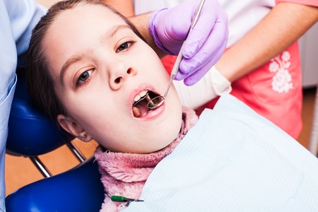 Methods of Teeth Bite Correctionの写真素材