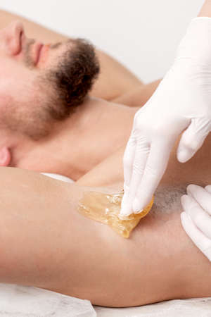 Depilation and epilation male armpit with liquid sugar paste. Hand of cosmetologist applying wax paste on armpit of man. Smooth underarm conceptの写真素材