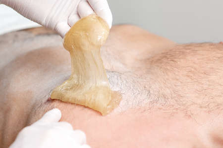 Epilation chest of young male with liquid wax paste by hands of female cosmetologist in beauty salon