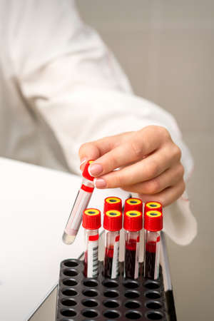 Hand of lab technician or nurse takes empty blood test tube from rack in the research laboratory