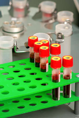 Test tubes with blood samples in rack and in centrifuge machine in the lab