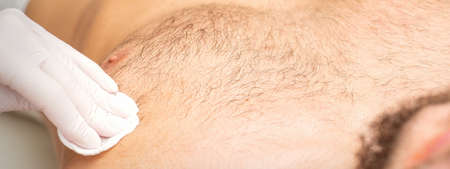 Young caucasian man receiving hair removal from his chest in a beauty salon, depilation mens torso