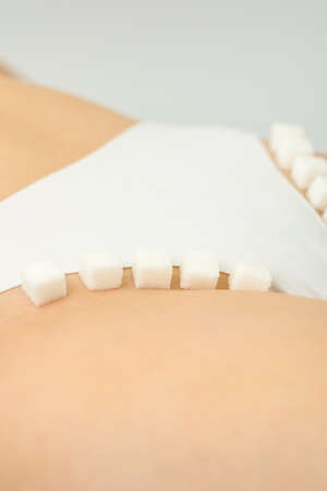 Sugar cubes lying in a row on female bikini zone, the concept of intimate depilation, problems of...