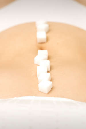 Sugar cubes lying in a row on abdomen of young woman, the concept of intimate depilation, problems...