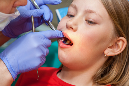 Stomatology checks up teeth for a child, girl on a reception for stomatologyの写真素材