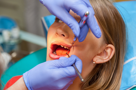 Stomatology checks up teeth for a child, girl on a reception for stomatologyの写真素材