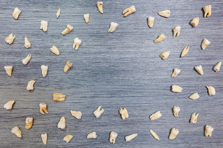 Broken teeth are on the table. Teeth of peopleの写真素材