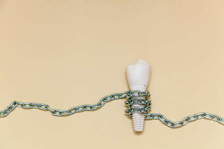 Dental implant is twisted with a metal chain on a beige background. Dental implant model of artificial tooth. Concept of dentistry and medical instruments. Photo with place for your text and design.の写真素材