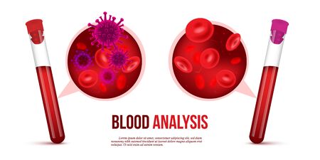Realistic vector blood analysis medical conceptのイラスト素材