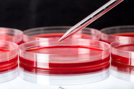 Petri dishes used in a biotechnology medical research