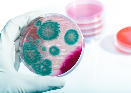 Petri dish with bacteria Listeria monocytogenes in a hand of scientist