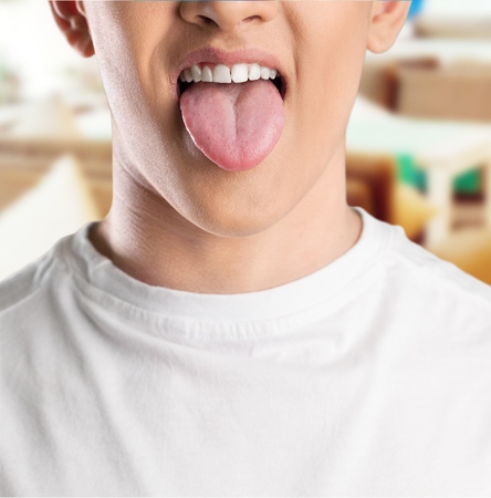 Tongue with Candida albicansの写真素材
