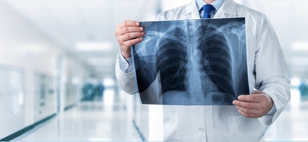 Doctor looking chest x-ray film in hospital