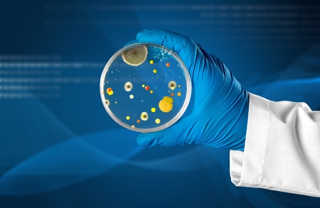 Microbiology laboratory test in scientist hand on
