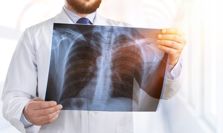 Doctor examining chest x-ray film of patient at hospital.の写真素材