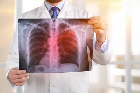 Doctor examining chest x-ray film of patient at hospital.